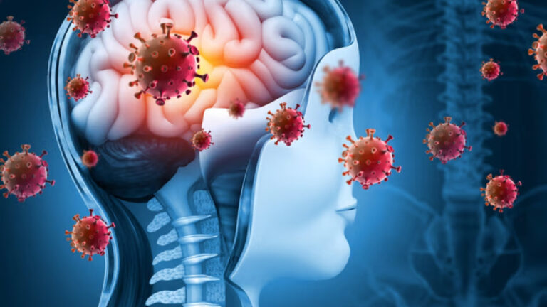 hantavirus-paniginden-sonra-bir-salgin-daha-ingilterede-1-kisi-oldu-2-kisi-tedavi-altinda-qSTajJ5s